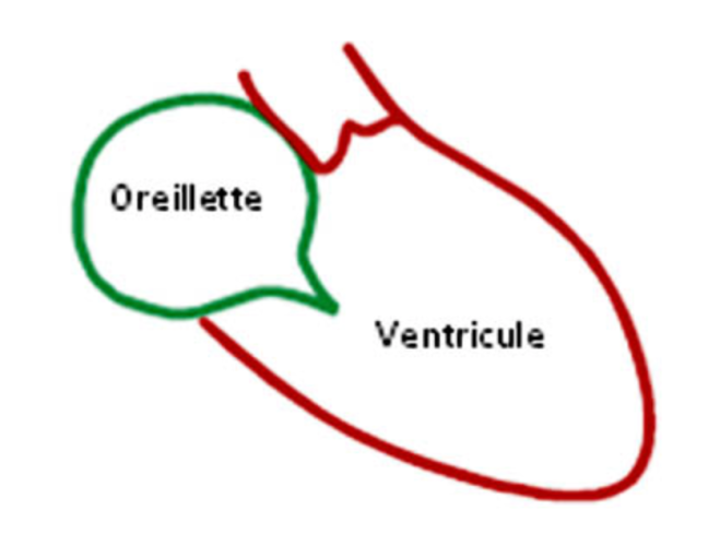 Contraction iso-volumique - Sémiologie cardiologique - campus.cerimes.fr