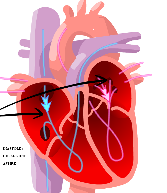 Diastole : Le sang est aspiré - Comment le pacemaker a-t-il révolutionné la cardiologie ? - stimulateur-cardiaque.e-monsite.com