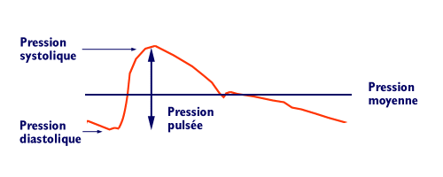 Enregistrement de la pression artérielle à l'aide d'un capteur introduit dans l'aorte - hypertension-online.com